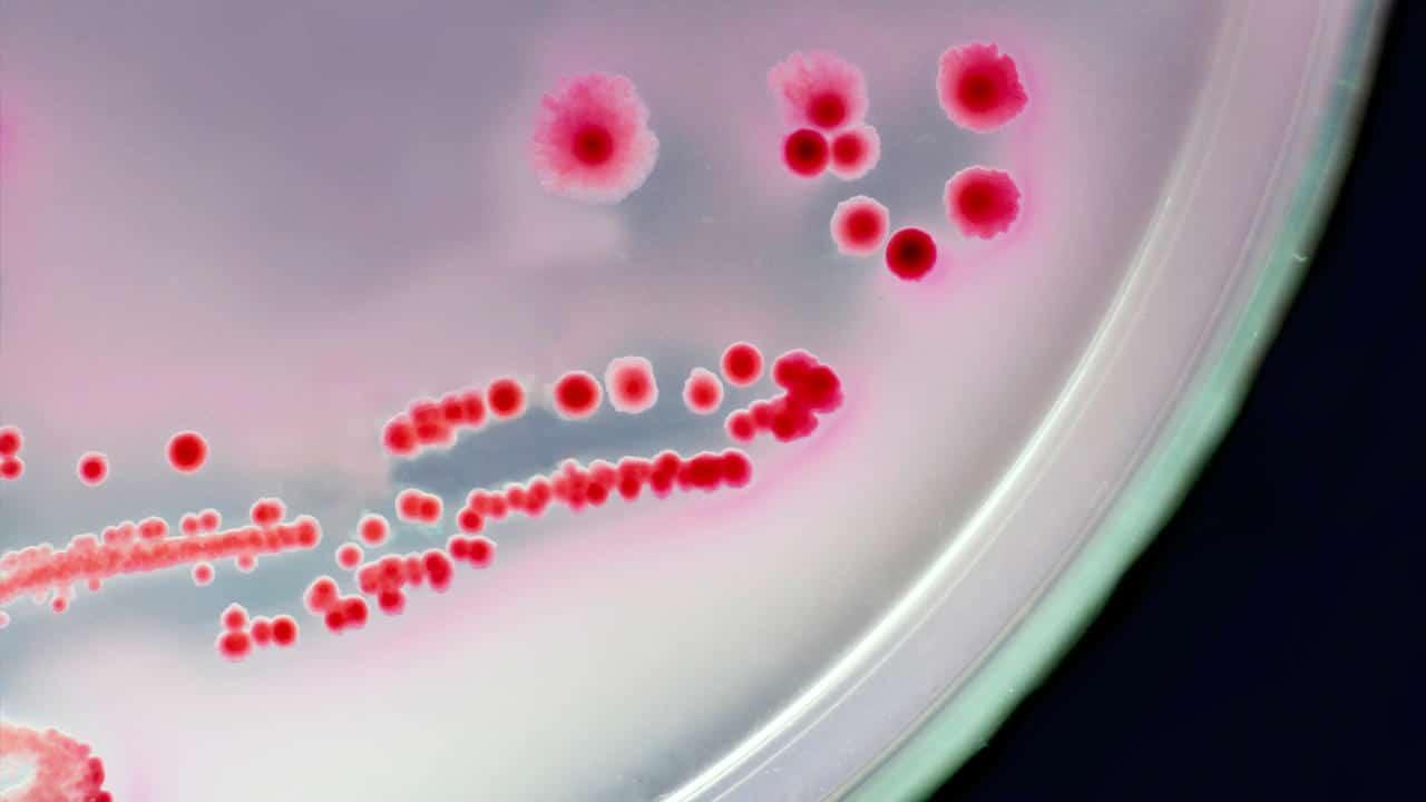 ما هي أعراض نقص البكتيريا النافعة في جسمك