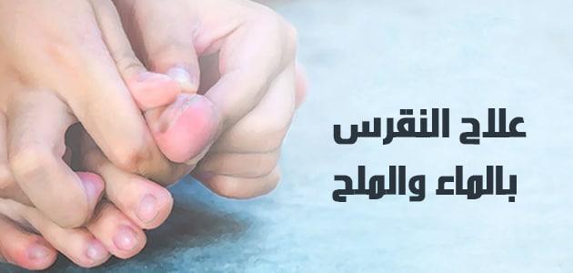 علاج النقرس بالماء والملح