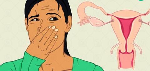 علاج رائحة المهبل الكريهة للحامل